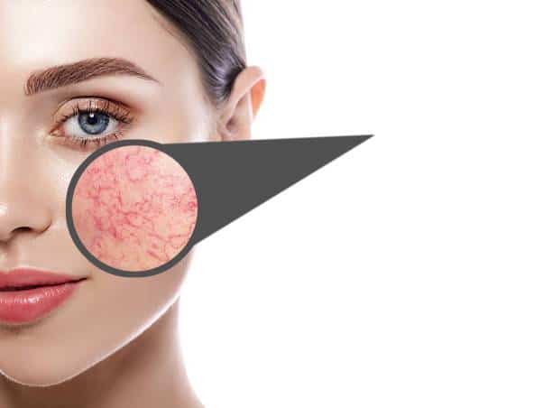 istockphoto1297458970612x612jpg_63e2298717712